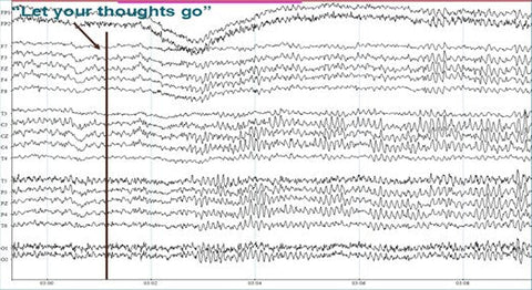 Unpredictable Nature of Alpha Brain Waves During an EEG Recording